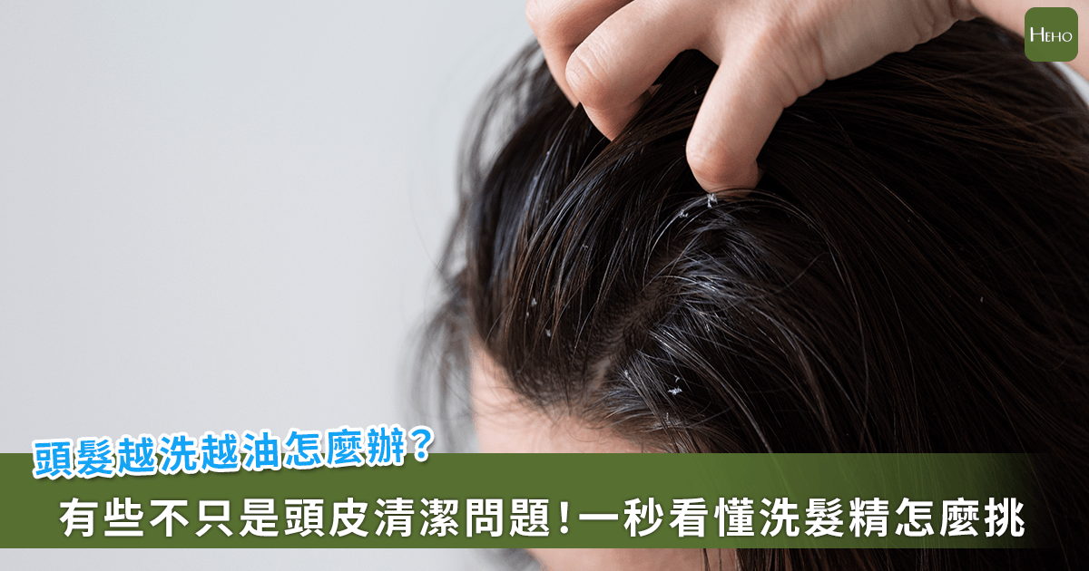 「你洗掉的是油，還是頭髮？」趙昭明：越洗越油是警訊 洗對方法更蓬鬆